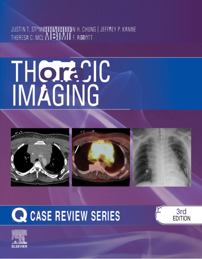 Thoracic Imaging: Case Review 3rd Edition By Justin Stowell, Jonathan Chung, Jeffrey Kanne, Theresa McLoud, Gerald Abbott