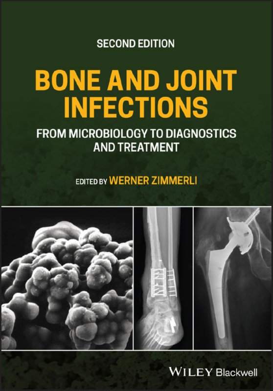 eBook BONE AND JOINT INFECTIONS from microbiology to diagnostics and treatment. 2nd Edition By Werner Zimmerli