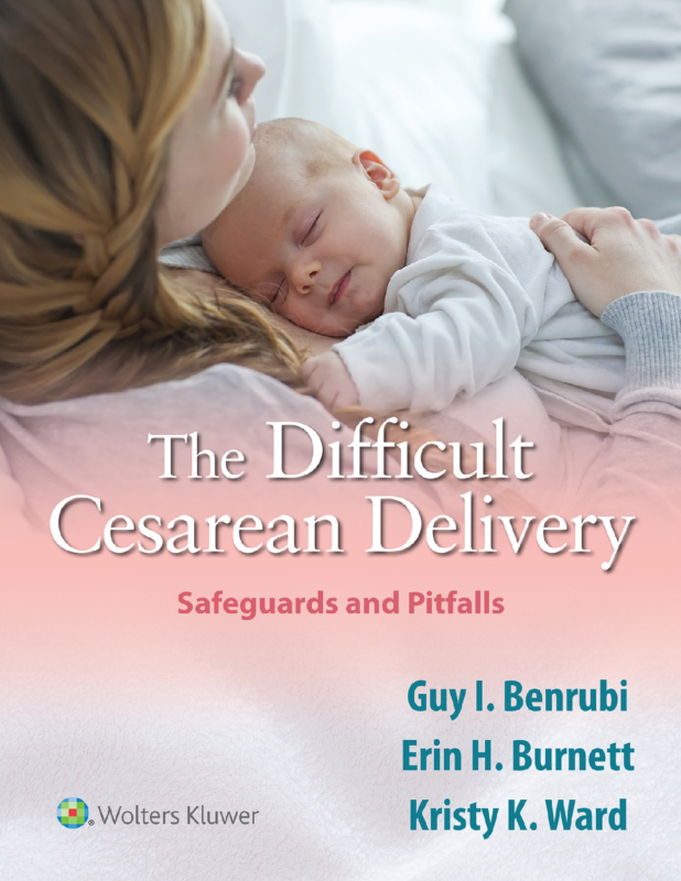 eBook The Difficult Cesarean Delivery Safeguards and Pitfalls 1st dition By Guy I. Benrubi, Erin H. Burnett, Kirsty K. Ward