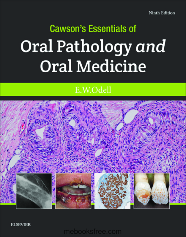 Cawson’s Essentials of Oral Pathology and Oral Medicine. Roderick A. 9th Edition by Edward W. Odell