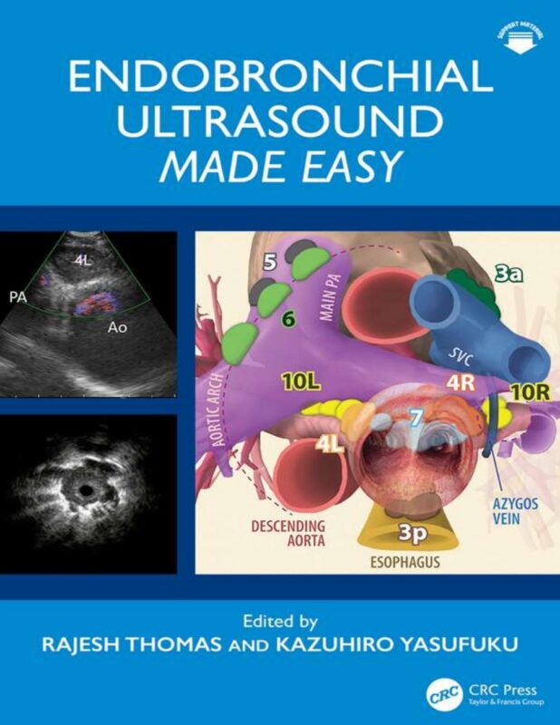 Endobronchial Ultrasound Made Easy 1st Edition By Rajesh Thomas, Kazuhiro Yasufuku