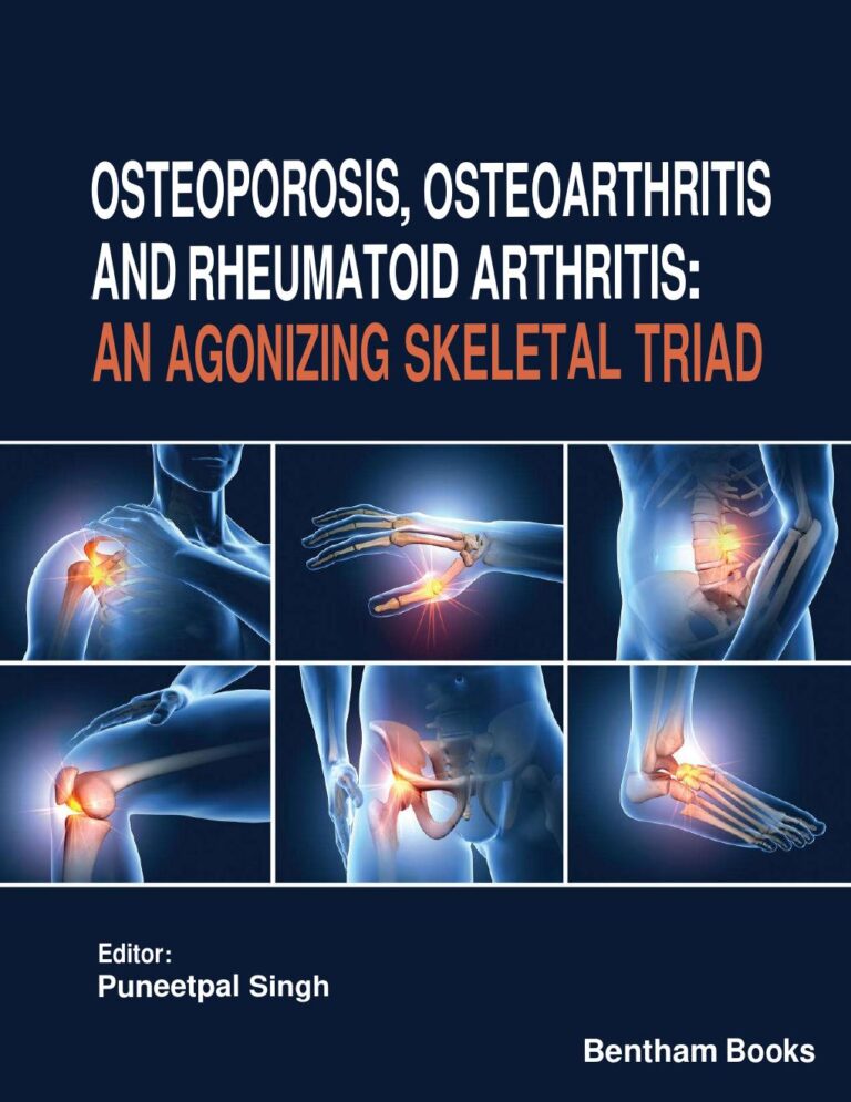 Osteoporosis Osteoarthritis and Rheumatoid Arthritis An Agonizing Skeletal Triad 1st Edition By Puneetpal Singh